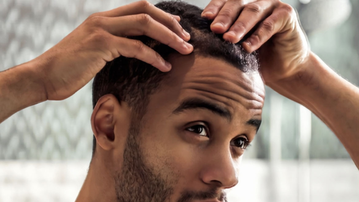 FUE Hair Transplant